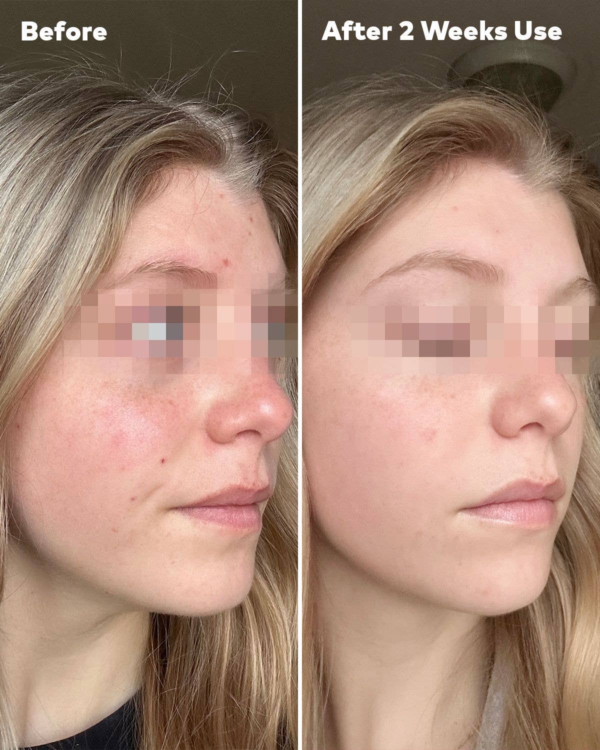 Silver-Infused Mini PRO: Antibacterial MakeUp Eraser for Acne-Prone Skin - Bella Blossom Boutique
